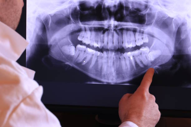 Best Tooth Infection Emergency Dentist  in Northfield, NJ